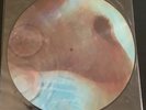 Pink Floyd Super Rare Meddle Picture Disc Emi Shvl 795-p Collectible Lp Vg+