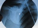 YARDBIRDS - FOR YOUR LOVE - USSR GEORGIAN X-RAY ROENTGEN BONES RECORD