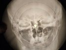 Beatles - Back In The U.S.S.R. X-RAY BONE OF THE USSR X-RAY RECORDING SKULL