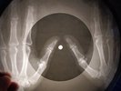 Beatles - Birthday X-RAY OF THE USSR X-RAY BONE RECORDING