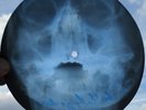 THE BEATLES - LONG TALL SALLY - USSR GEORGIAN X-RAY ROENTGEN SKULL RECORD