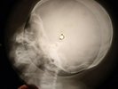 Ray Charles - Hit The Road Jack X-RAY BONE OF THE USSR RECORDING SKULL