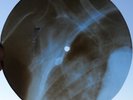 THE BEATLES - I NEED YOU - USSR GEORGIAN X-RAY ROENTGEN BONES RECORD