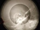 Ray Charles - Basin Street Blues X-RAY BONE OF THE USSR X-RAY RECORDING SKULL