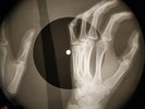 Bob Marley - Buffalo Soldier X-RAY BONE RECORDING X-RAY USSR