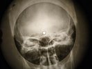 Rolling Stones - I Wanna Be Your Man X-RAY USSR BONE X-RAY RECORD