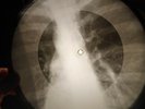 Ray Charles - Carry Me Back to Old Virginny X-RAY USSR X-RAY BONE RECORDING