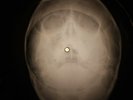 Elvis Presley - My Baby Left Me X-RAY OF THE USSR X-RAY BONE RECORD