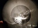 Beach Boys - Don't Worry Baby X-RAY OF THE USSR RECORDING X-RAY BONES