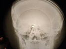 Jefferson Airplane - White Rabbit X-RAY OF THE USSR  X-RAY RECORDING  BONES
