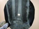 DAVID BOWIE RUBBER BAND X-Ray USSR Record Roentgen Bones Ribs Music Vinyl