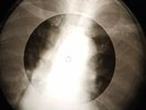 Bobby Vee - Devil Or Angel  X-RAY OF THE USSR X-RAY BONE RECORDING