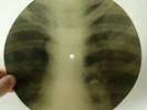 X-RAY 78rpm LESHCHENKO 