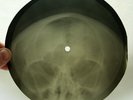 X-RAY 78rpm GEORGIAN POP SONG Vocal Group & Band USSR ROENTGEN BONES Skull 1960s
