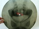 X-RAY 78rpm WILL GLAHE Beer Barrel Polka RARE USSR ROENTGEN Pelvic Coccyx 1950s