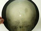X-RAY 78rpm 8