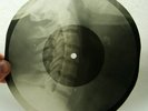 X-RAY 78rpm RAFI SAHAB Song from Indian Film RARE USSR ROENTGEN BONES Neck 1960s