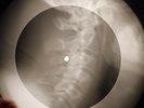 Elvis Presley - Santa Bring My Baby Back X-RAY OF USSR X-RAY BONE RECORD