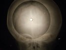 Louis Armstrong - Hello Dolly X-RAY OF THE USSR X-RAY BONES RECORD