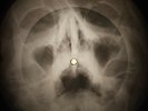 Rolling Stones - I wanna be your man  X-RAY OF USSR X-RAY BONE RECORD