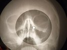 Creedence Clearwater Revival - My Baby Left Me X-RAY OF USSR X-RAY BONES RECORD