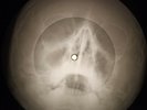 Creedence Clearwater Revival - Ooby Dooby X-RAY OF THE USSR BONES RECORD