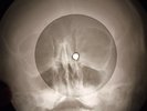 Louis Prima - Pennies From Heaven X-RAY OF THE USSR X-RAY BONES RECORDING
