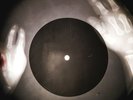 Ben E. King - Stand By Me X-RAY OF USSR X-RAY BONE RECORDING