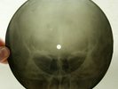 X-RAY 78rpm 7