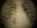 Beach Boys - Good Vibrations X-RAY OF THE USSR X-RAY BONE RECORDING