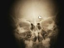 Rolling Stones - Heart of stone X-RAY OF THE USSR X-RAY BONES RECORDING