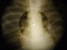 John Lennon - Woman X-RAY OF THE USSR X-RAY BONES RECORD