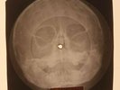 Velvet Underground - That's The Story Of My Life X-RAY OF USSR X-RAY BONE RECORD