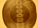 Louis Armstrong - Hello, Dolly   X-RAY OF USSR X-RAY BONES RECORD