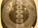 Beatles - Please Mister Postman X-RAY OF THE USSR X-RAY BONE RECORD