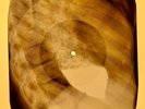 Roy Orbison - Running Scared  X-RAY OF USSR X-RAY BONES RECORDING