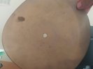 USSR GEORGIAN X-RAY ROENTGEN RECORD  UNIQUE ITEM