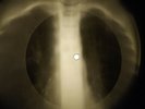 Rolling Stones - Ride On Baby X-RAY OF USSR X-RAY BONE RECORDING