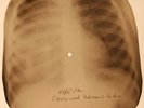 Bobby Vee - Devil Or Angel  X-RAY OF USSR X-RAY BONES RECORDING