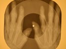 Beatles - Rock and Roll Music X-RAY OF THE USSR X-RAY BONES RECORDING
