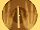 Ben E. King - Stand by Me X-RAY OF USSR X-RAY BONE RECORD