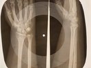 Beatles - Tell Me Why X-RAY OF THE USSR X-RAY BONES RECORD