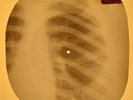 Creedence Clearwater Revival - Molina X-RAY OF USSR X-RAY BONES RECORD