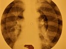 Little Richard - Bama Lama Bama Loo X-RAY OF USSR X-RAY BONE RECORD