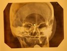 Beatles - Can't Buy Me Love X-RAY OF THE USSR X-RAY BONE RECORDING