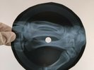BILLY FURY ONCE UPON A DREAM X-Ray USSR Record Roentgen Bones Ribs Music Vinyl