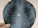 FRANK SINATRA PS I LOVE YOU X-Ray USSR Record Roentgen Bones Ribs Music Vinyl