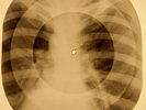Beatles - No Reply X-RAY OF THE USSR X-RAY BONES RECORD