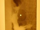 Elvis Presley - Like A Baby X-RAY OF THE USSR X-RAY BONE RECORDING