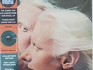 Johnny & Edgar Winter 